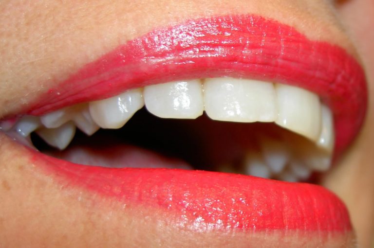 Are Teeth Supposed To Be White All Things Mindful